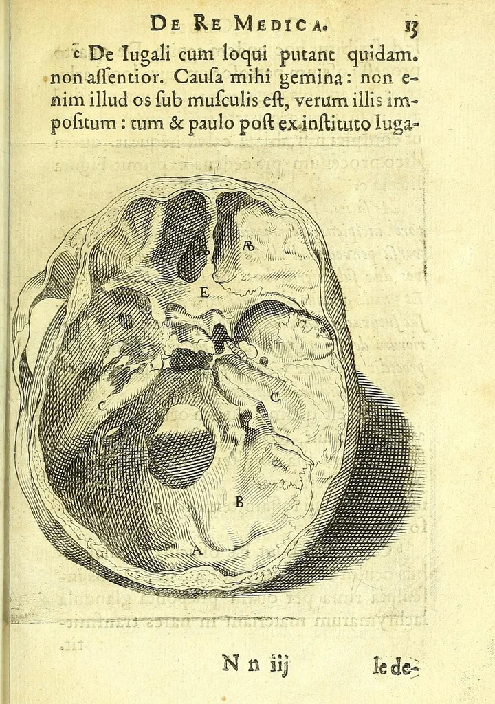An illustration from Succenturiatus anatomicus : continens commentaria in Hippocratem : De capitis vulneribus :, 1616, leaf 319