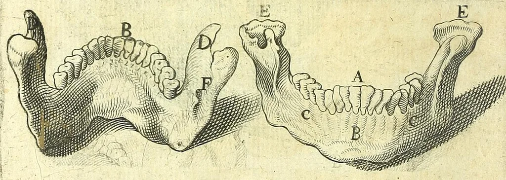 An illustration from Succenturiatus anatomicus : continens commentaria in Hippocratem : De capitis vulneribus :, 1616, leaf 328