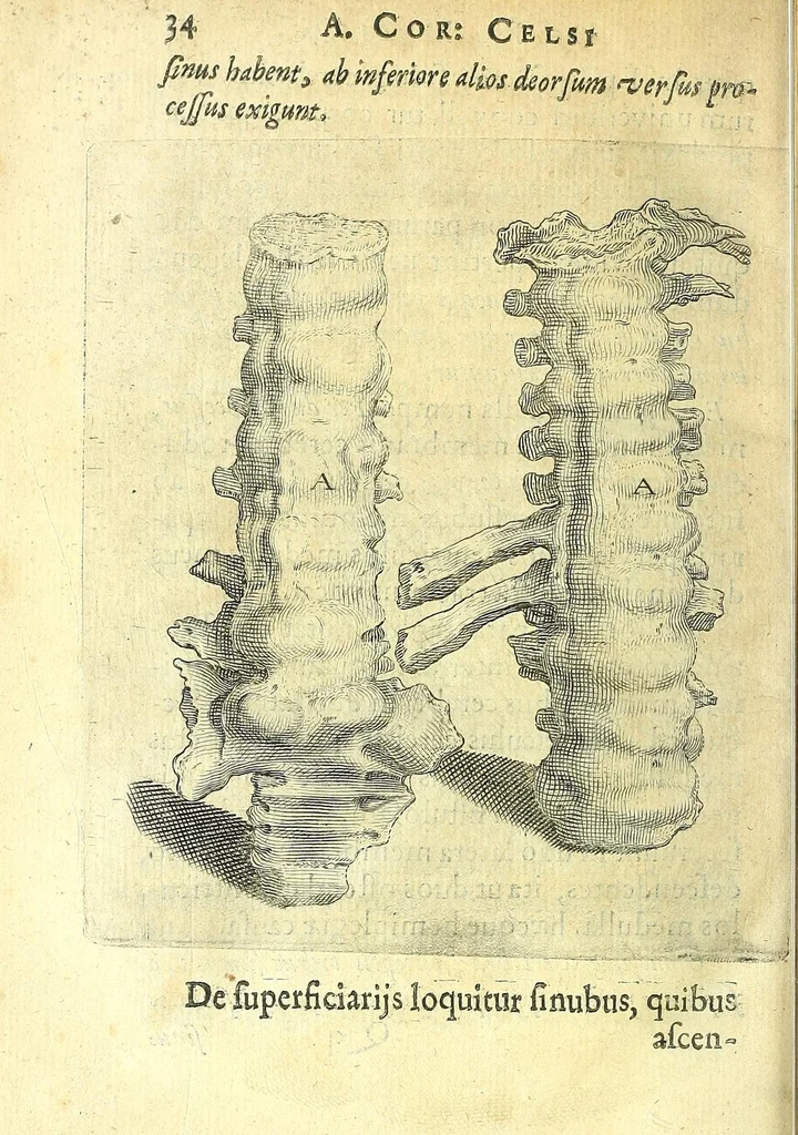 An illustration from Succenturiatus anatomicus : continens commentaria in Hippocratem : De capitis vulneribus :, 1616, leaf 340