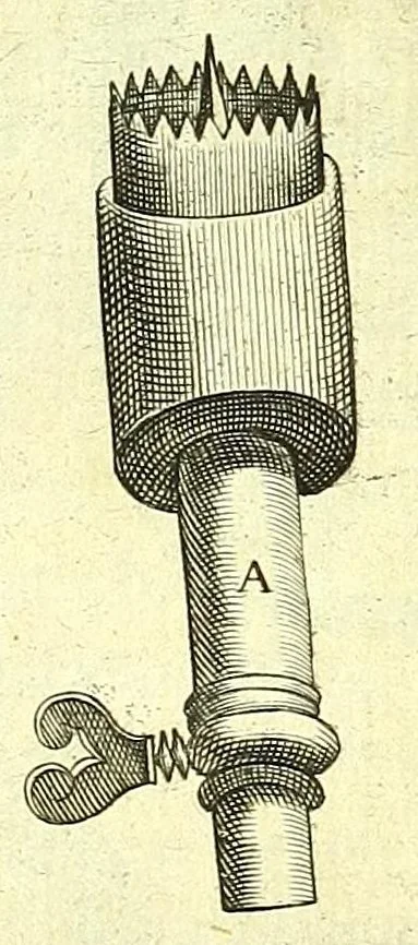 An illustration from Succenturiatus anatomicus : continens commentaria in Hippocratem : De capitis vulneribus :, 1616, leaf 389