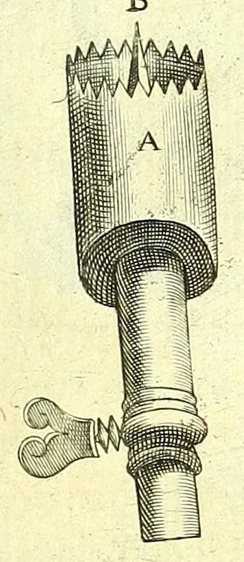 An illustration from Succenturiatus anatomicus : continens commentaria in Hippocratem : De capitis vulneribus :, 1616, leaf 389