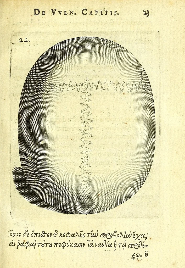 An illustration from Succenturiatus anatomicus : continens commentaria in Hippocratem : De capitis vulneribus :, 1616, leaf 57