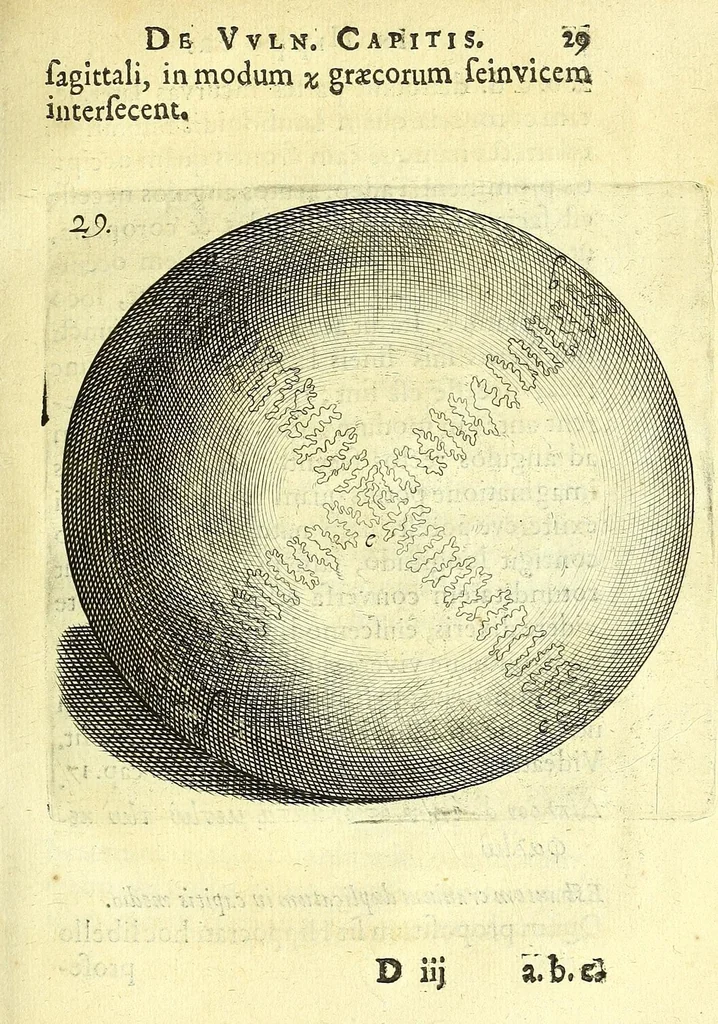 An illustration from Succenturiatus anatomicus : continens commentaria in Hippocratem : De capitis vulneribus :, 1616, leaf 63