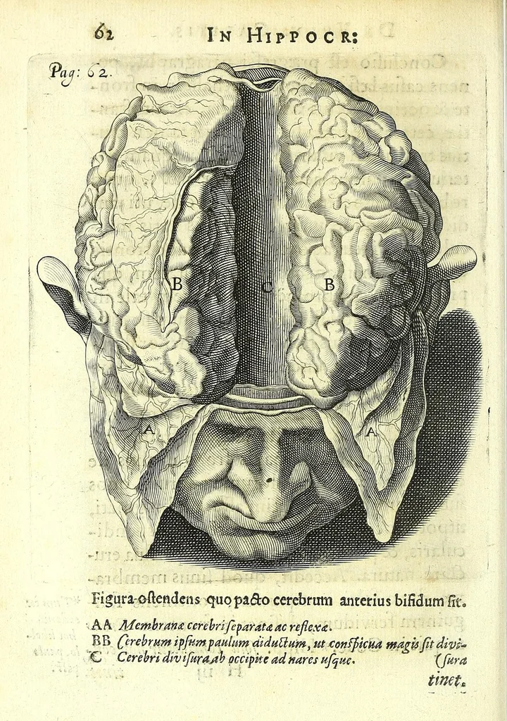 An illustration from Succenturiatus anatomicus : continens commentaria in Hippocratem : De capitis vulneribus :, 1616, leaf 98