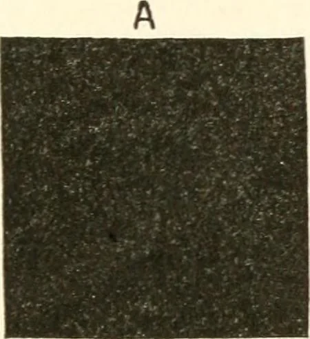 An illustration from Suggestion and psychotherapy, 1912, leaf 142