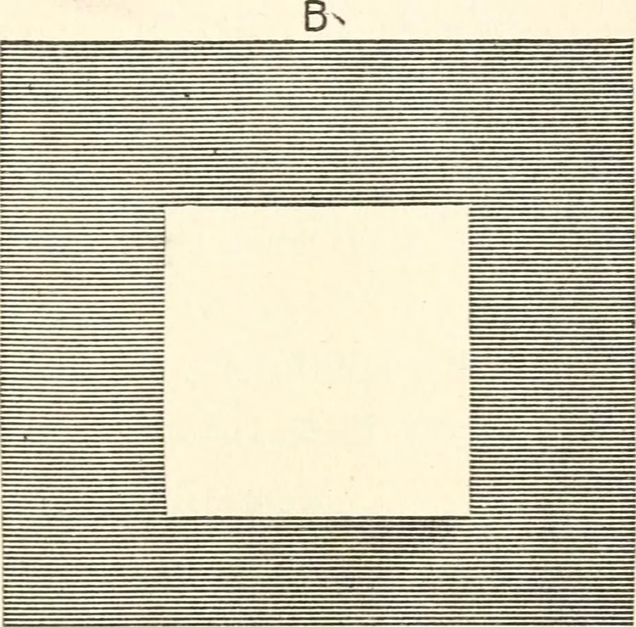 An illustration from Suggestion and psychotherapy, 1912, leaf 142