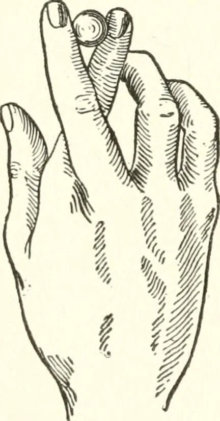 An illustration from Suggestion and psychotherapy, 1912, leaf 143