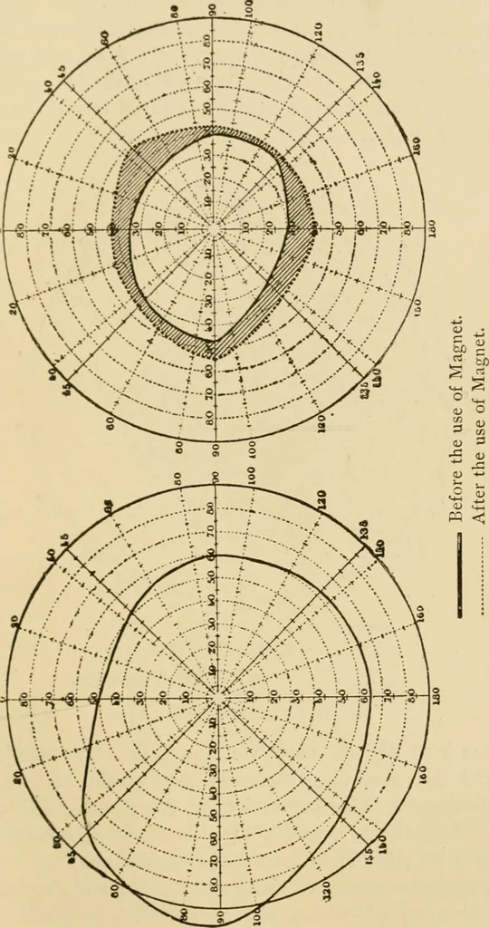 An illustration from Suggestive therapeutics : a treatise on the nature and uses of hypnotism, 1889, leaf 284