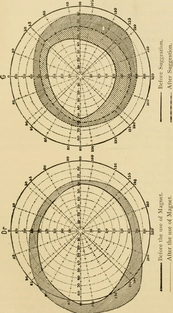 An illustration from Suggestive therapeutics : a treatise on the nature and uses of hypnotism, 1889, leaf 288