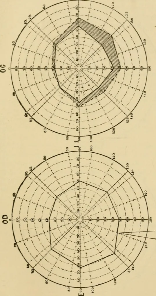 An illustration from Suggestive therapeutics : a treatise on the nature and uses of hypnotism, 1889, leaf 296