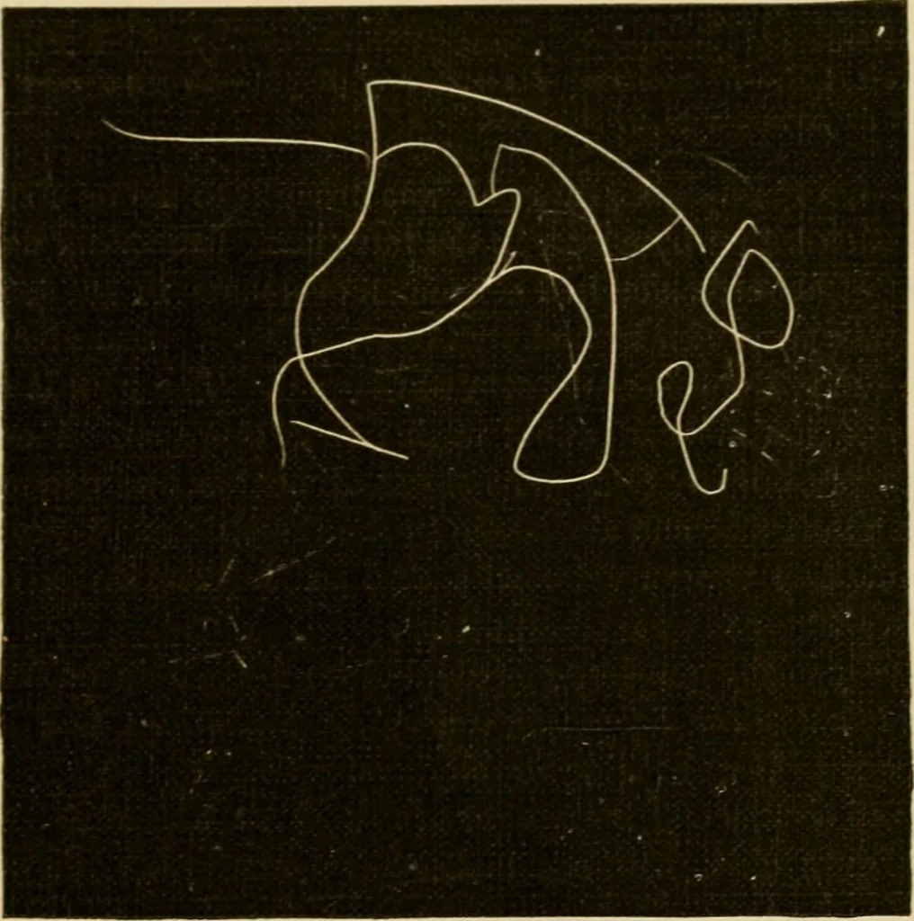 An illustration from Suggestive therapeutics : a treatise on the nature and uses of hypnotism, 1889, leaf 358