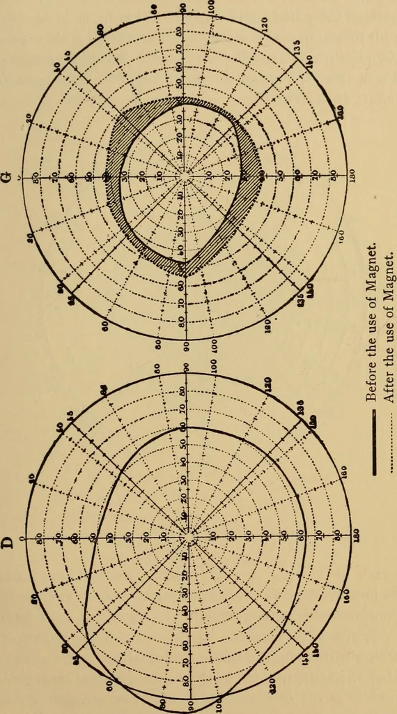 An illustration from Suggestive therapeutics : a treatise on the nature and uses of hypnotism, 1880, leaf 286