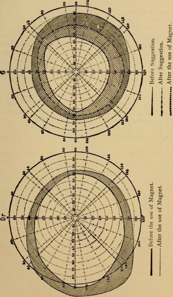 An illustration from Suggestive therapeutics : a treatise on the nature and uses of hypnotism, 1880, leaf 290