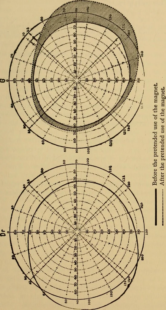 An illustration from Suggestive therapeutics : a treatise on the nature and uses of hypnotism, 1880, leaf 292