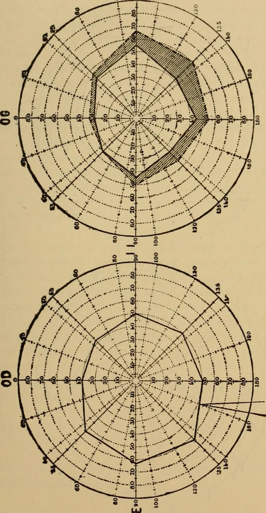 An illustration from Suggestive therapeutics : a treatise on the nature and uses of hypnotism, 1880, leaf 298