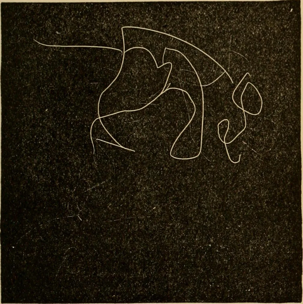 An illustration from Suggestive therapeutics : a treatise on the nature and uses of hypnotism, 1880, leaf 360