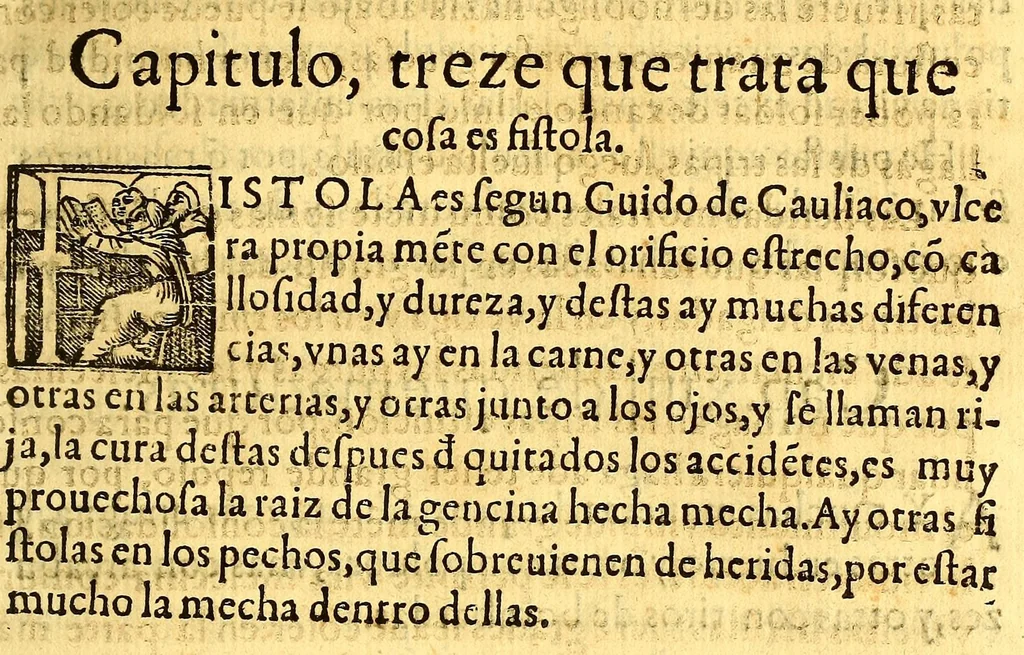 An illustration from Summa y recopilacion de cirugia, con un arte para sangrar, y examen de barberos,, 1595, leaf 299