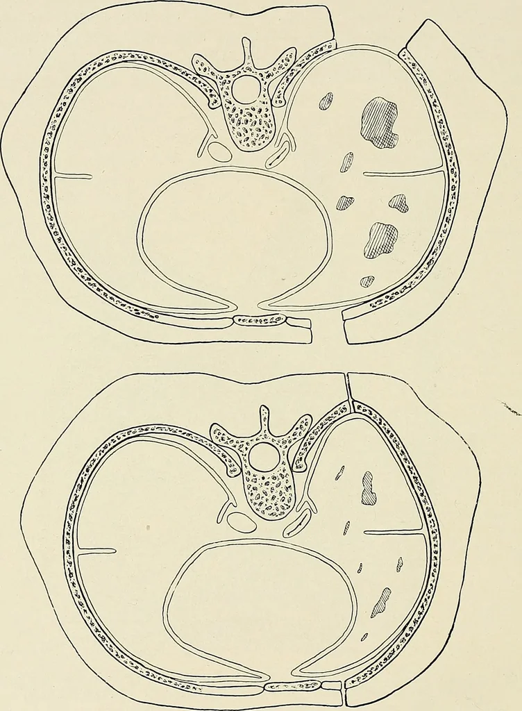 An illustration from Surgery of the lung, 1913, leaf 183