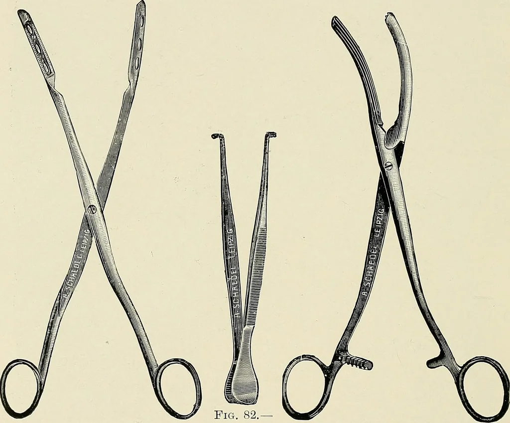 An illustration from Surgery of the lung, 1913, leaf 209