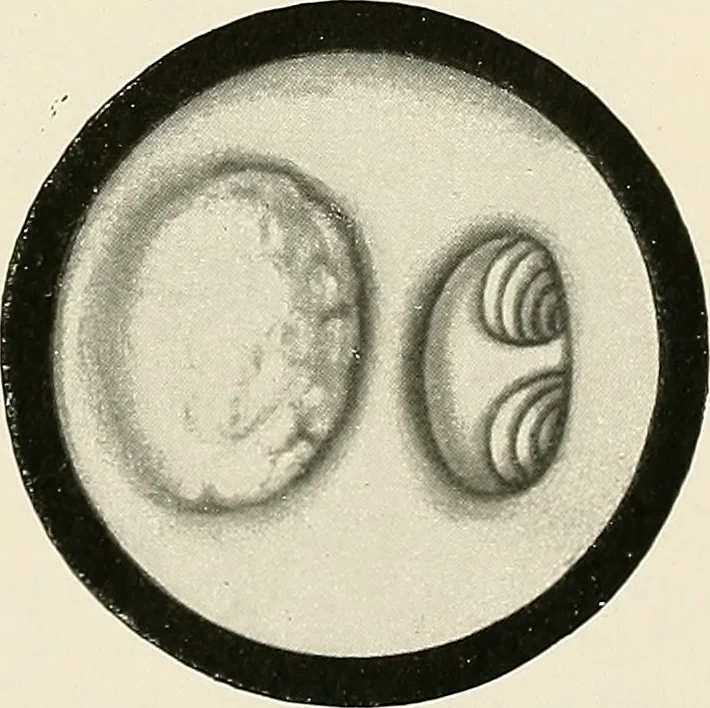 An illustration from Surgery of the lung, 1913, leaf 218