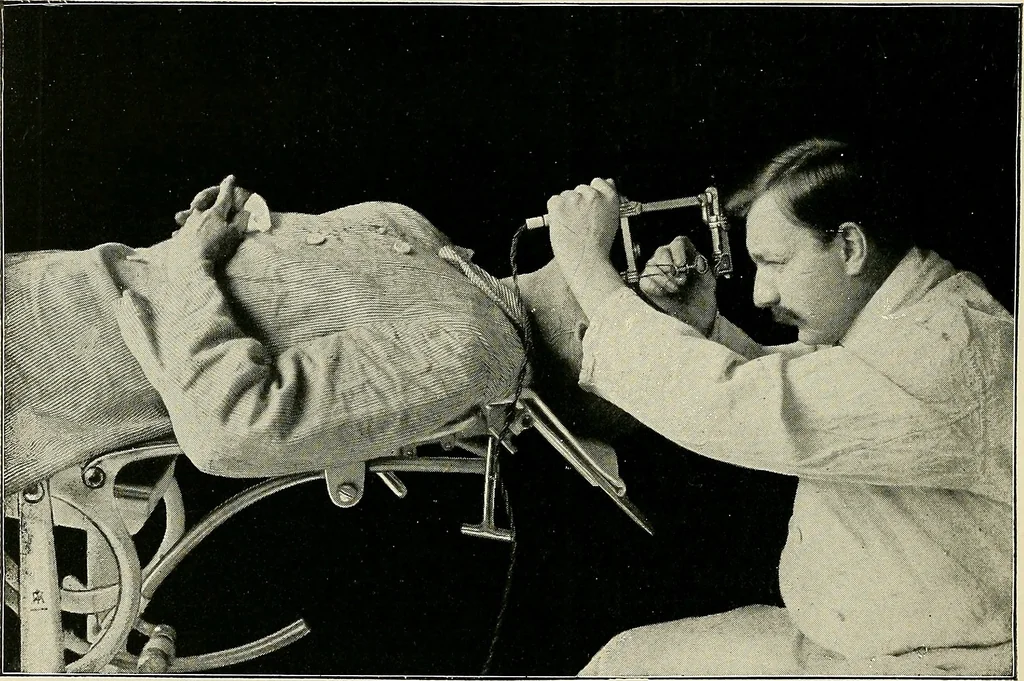 An illustration from Surgery of the lung, 1913, leaf 237