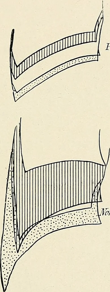 An illustration from Surgery of the lung, 1913, leaf 266