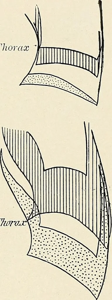 An illustration from Surgery of the lung, 1913, leaf 266