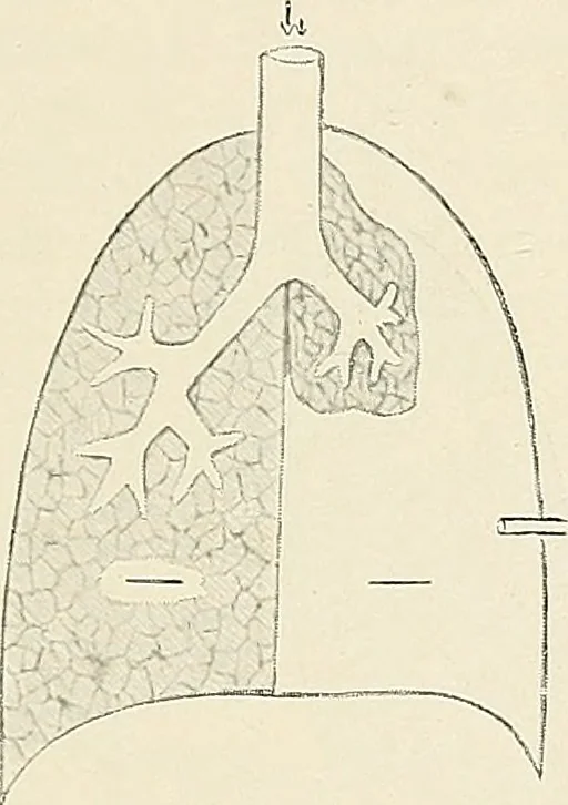 An illustration from Surgery of the lung, 1913, leaf 38