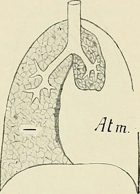 An illustration from Surgery of the lung, 1913, leaf 39