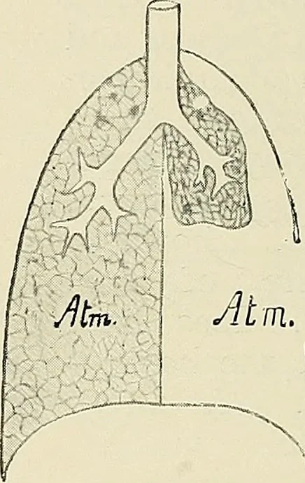 An illustration from Surgery of the lung, 1913, leaf 39