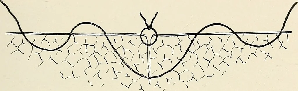 An illustration from Surgery of the lung, 1913, leaf 84