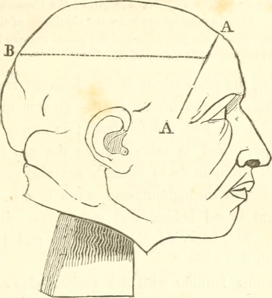 An illustration from A system of phrenology, 1835, leaf 106