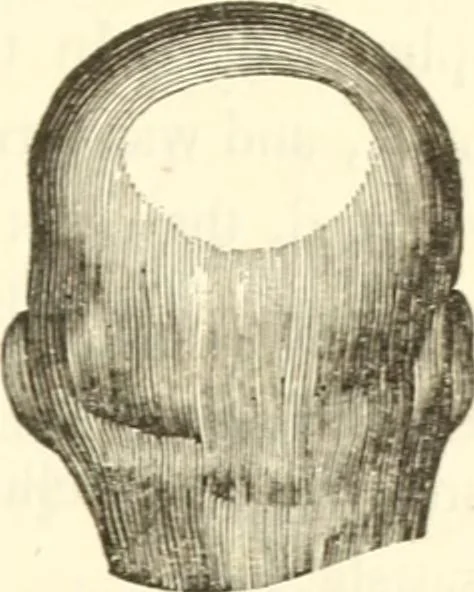 An illustration from A system of phrenology, 1835, leaf 134