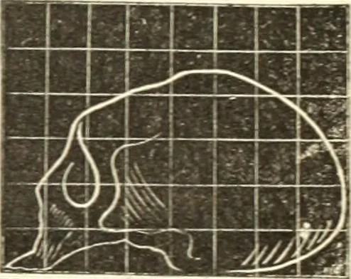 An illustration from A system of phrenology, 1835, leaf 146