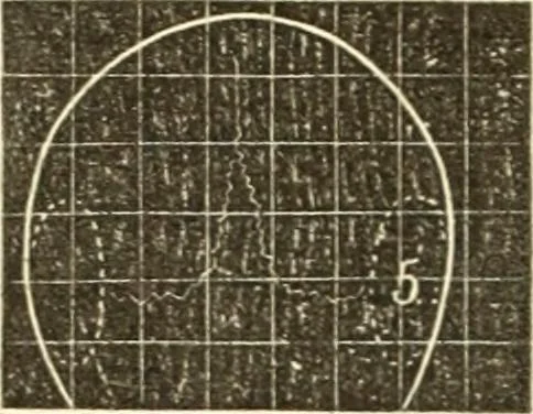 An illustration from A system of phrenology, 1835, leaf 175