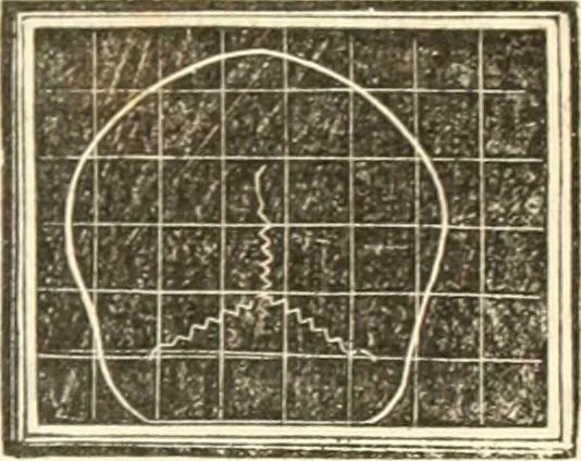 An illustration from A system of phrenology, 1835, leaf 192