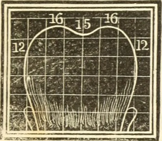 An illustration from A system of phrenology, 1835, leaf 306