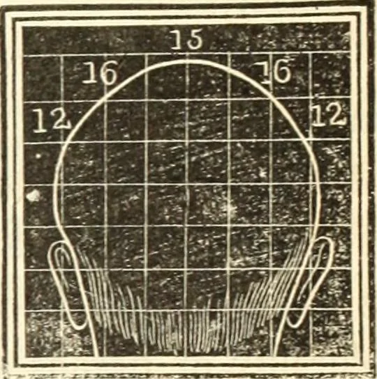 An illustration from A system of phrenology, 1835, leaf 306