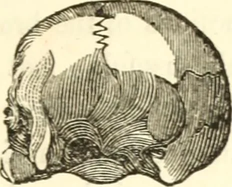 An illustration from A system of phrenology, 1835, leaf 58