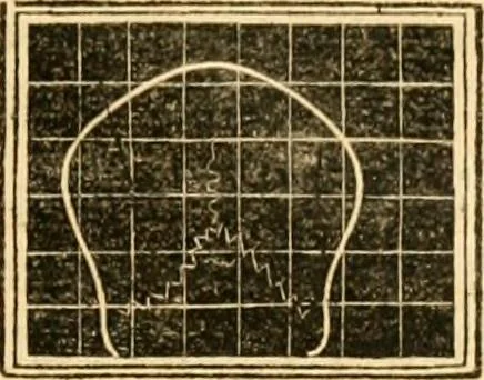 An illustration from A system of phrenology, 1830, leaf 182