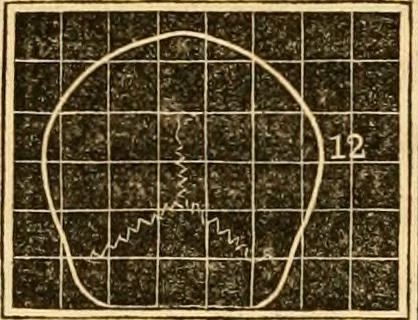 An illustration from A system of phrenology, 1830, leaf 273