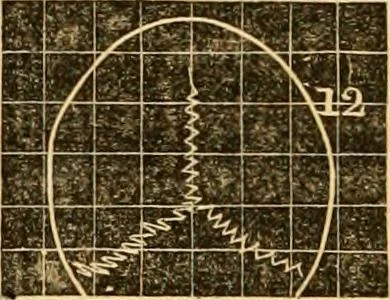 An illustration from A system of phrenology, 1830, leaf 273