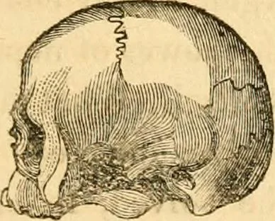 An illustration from A system of phrenology, 1830, leaf 56
