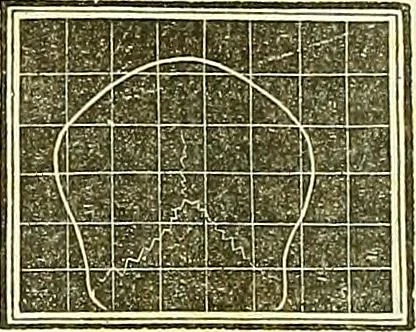 An illustration from A system of phrenology, 1839, leaf 171