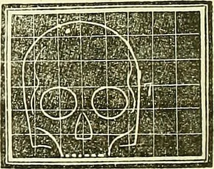 An illustration from A system of phrenology, 1839, leaf 215
