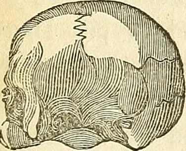 An illustration from A system of phrenology, 1839, leaf 232