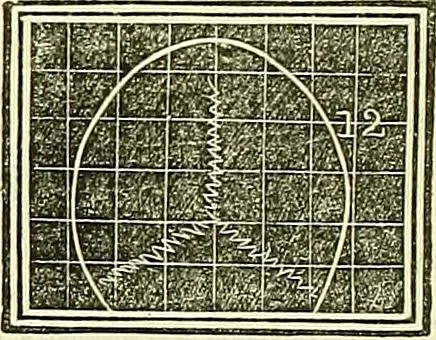 An illustration from A system of phrenology, 1839, leaf 261