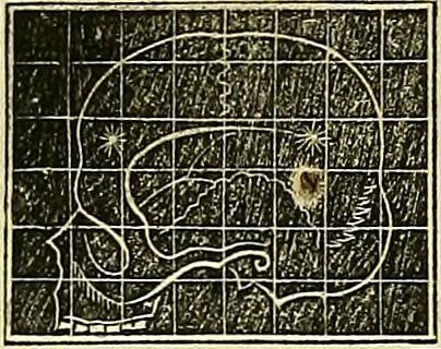 An illustration from A system of phrenology, 1839, leaf 607