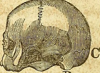 An illustration from A system of phrenology, 1839, leaf 93