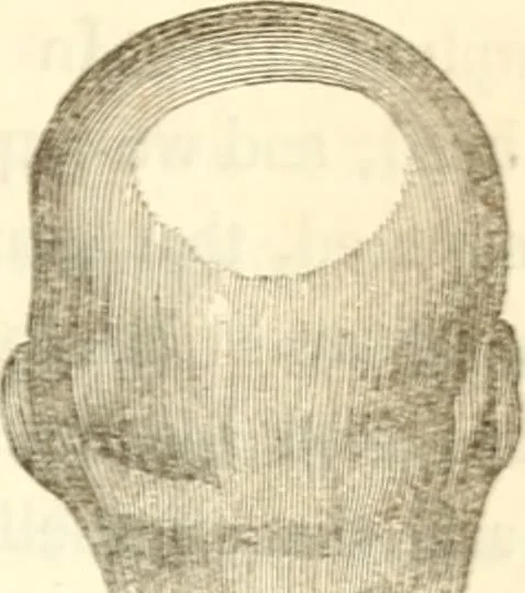 An illustration from A system of phrenology, 1839, leaf 128